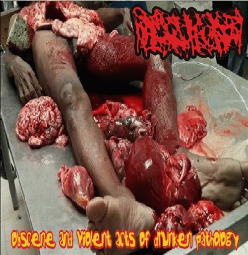 Hydrocephalus : Obscene and Violent Acts of Drunken Pathology Hydrocephalus : Obscene and Violent Acts of Drunken Pathology